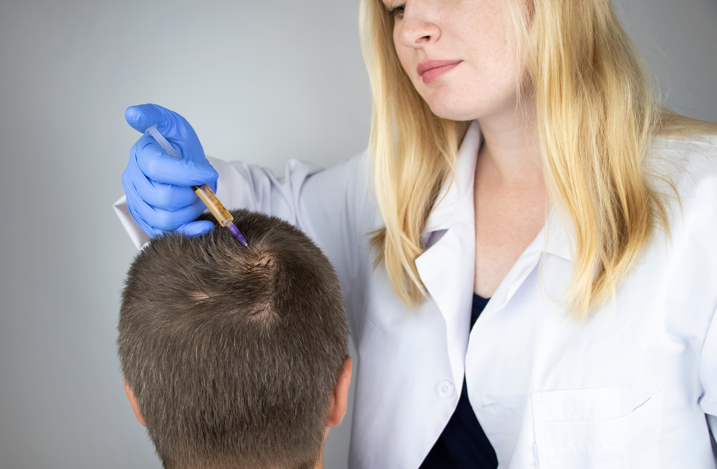 Trichologist Examining Scalp of Patient with Alopecia